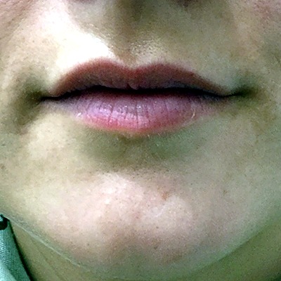 Before